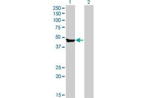 Western Blot analysis of CPA2 expression in transfected 293T cell line by CPA2 MaxPab polyclonal antibody. (Carboxypeptidase A2 抗体  (AA 1-417))