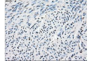 Immunohistochemistry (IHC) image for anti-Carbonic Anhydrase IX (CA9) antibody (ABIN1497095) (CA9 抗体)