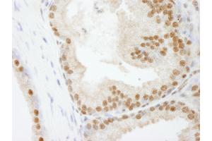Immunohistochemistry (IHC) image for anti-Polymerase (DNA-Directed), delta 3, Accessory Subunit (POLD3) (AA 325-375) antibody (ABIN7448732)
