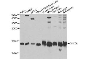 Western blot analysis of extracts of various cell lines, using COX5A Antibody. (COX5A 抗体  (AA 1-150))