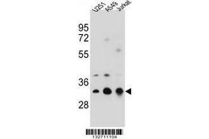 TPM4 Antibody (N-term) western blot analysis in U251,A549,Jurkat cell line lysates (35 µg/lane). (Tropomyosin 4 抗体  (N-Term))