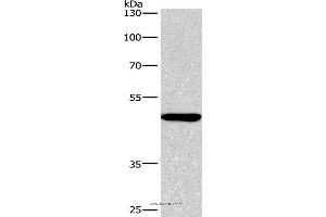 Western blot analysis of A549 cell, using BMP15 Polyclonal Antibody at dilution of 1:266. (BMP15 抗体)