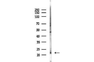 anti-Claudin 2 (CLDN2) (C-Term) antibody
