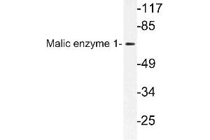 Western blot (WB) analysis of Malic enzyme 1 antibody in extracts from HeLa cells. (ME1 抗体)