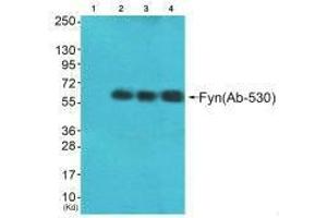 Western blot analysis of extracts from HeLa cells (Lane 2), A549 cells (Lane 3) and HepG2 cells (Lane 4), using Fyn (Ab-530) antiobdy. (FYN 抗体  (Tyr530))