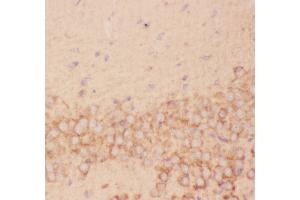 Anti-FSH beta Picoband antibody,  IHC(P): Mouse Brain Tissue (FSHB 抗体  (AA 19-129))