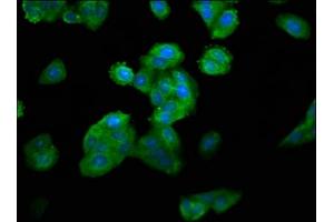 Immunofluorescence staining of HepG2 cells with ABIN7160580 at 1:100, counter-stained with DAPI. (MYH4 抗体  (AA 896-1045))