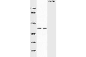 L1 Mouse intestine lysate L2 mouse liver lysates probed with Rabbit Anti-LAMP2/CD107B Polyclonal Antibody, Unconjugated  at 1:3000 for 90 min at 37˚C. (LAMP2 抗体  (AA 301-411))