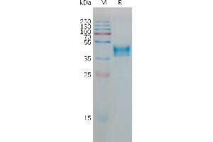 Hypocretin (Orexin) Receptor 1 (HCRTR1) (AA 1-46) protein (Fc Tag)