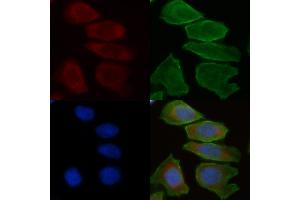 ABIN6258708 and ABIN6275305 staining Hela cells(30 min of UV treatment) by IF/ICC.