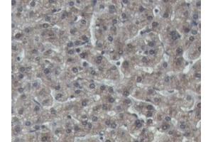 DAB staining on IHC-P; Samples: Porcine Liver Tissue (IGFBP4 抗体  (AA 23-259))