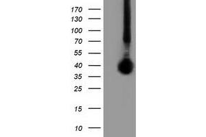 Western Blotting (WB) image for anti-Family with Sequence Similarity 84, Member B (FAM84B) antibody (ABIN1498208) (FAM84B 抗体)