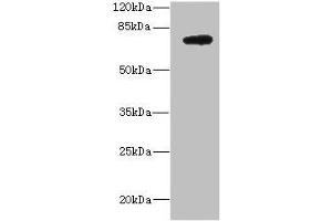 Western blot All lanes: DARS2 antibody at 10 μg/mL + MCF-7 whole cell lysate Secondary Goat polyclonal to rabbit IgG at 1/10000 dilution Predicted band size: 74 kDa Observed band size: 74 kDa (DARS2 抗体  (AA 489-628))