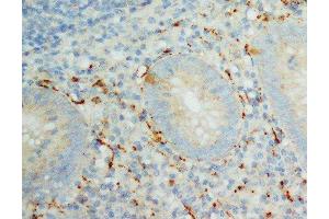 Anti-IL-8 antibody, IHC(P) IHC(P): Human Appendicitis Tissue (IL-8 抗体  (C-Term))