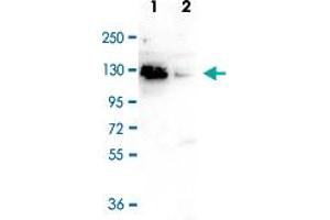 Western Blot (Cell lysate) analysis of (1) Negative control, and (2) 40 ug whole cell extracts of HeLa cells transfected with CTCF siRNA. (CTCF 抗体)