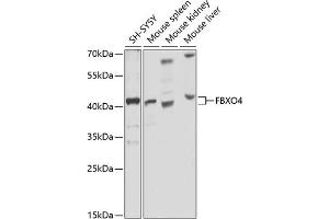 Western blot analysis of extracts of various cell lines, using FBXO4 antibody (ABIN6130382, ABIN6140525, ABIN6140526 and ABIN6225310) at 1:1000 dilution. (FBXO4 抗体  (AA 138-387))