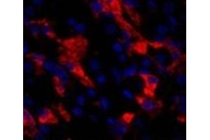 Immunofluorescence analysis of Human stomach tissue using CD284 Polyclonal Antibody at dilution of 1:200. (TLR4 抗体)
