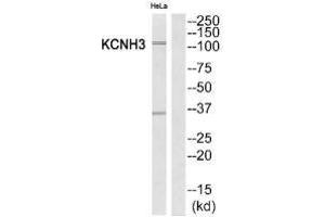 Western blot analysis of extracts from HeLa cells, using KCNH3 antibody. (KCNH3 抗体)