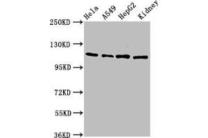 Western Blot Positive WB detected in: Hela whole cell lysate, A549 whole cell lysate, HepG2 whole cell lysate, Rat kidney tissue All lanes: NFATC3 antibody at 4. (NFATC3 抗体  (AA 887-1070))