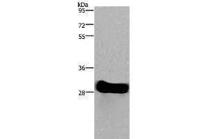 Western Blot analysis of Mouse heart tissue using FHL2 Polyclonal Antibody at dilution of 1:1900 (FHL2 抗体)