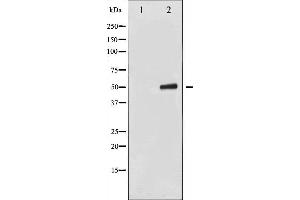 Western blot analysis of Keratin 8 phosphorylation expression in EGF treated 293 whole cell lysates,The lane on the left is treated with the antigen-specific peptide.
