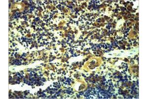 Immunohistochemistry (IHC) image for anti-Toll-Like Receptor 6 (TLR6) antibody (ABIN3179058) (TLR6 抗体)