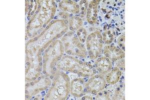Immunohistochemistry of paraffin-embedded rat kidney using ALDH1A1 antibody.