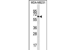GBP1 Antibody (N-term) (ABIN656423 and ABIN2845715) western blot analysis in MDA-M cell line lysates (35 μg/lane). (GBP1 抗体  (N-Term))