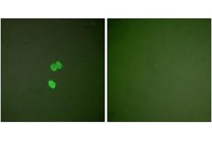 Immunofluorescence analysis of NIH-3T3 cells, using Galectin 3 Antibody. (Galectin 3 抗体  (AA 141-190))