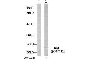 Image no. 2 for anti-BCL2-Associated Agonist of Cell Death (BAD) (pSer112), (pSer75) antibody (ABIN196734) (BAD 抗体  (pSer75, pSer112))