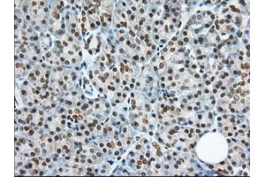 Immunohistochemical staining of paraffin-embedded Human Kidney tissue using anti-TACC3 mouse monoclonal antibody. (TACC3 抗体)