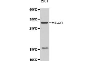 Western blot analysis of extracts of 293T cell line, using MEOX1 antibody.