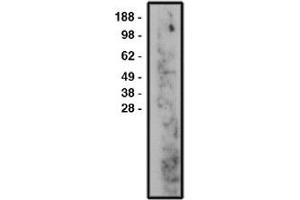 Image no. 1 for anti-Sphingomyelin Phosphodiesterase 3 (SMPD3) antibody (ABIN265269) (SMPD3 抗体)