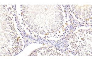 Immunohistochemistry (IHC) image for anti-Lysozyme (LYZ) (AA 19-148) antibody (ABIN7429331)