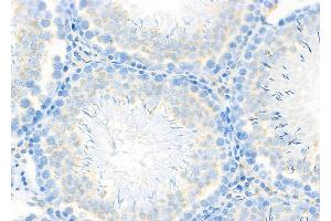 ABIN6262735 and ABIN6278108 at 1/100 staining Rat testis tissue by IHC-P.