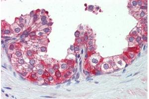 Prostate, Human: Formalin-Fixed, Paraffin-Embedded (FFPE)