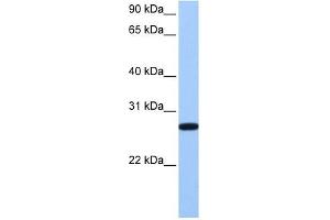 ECT2 antibody used at 1 ug/ml to detect target protein. (ECT2 抗体  (Middle Region))