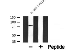 Western blot analysis of extracts from mouse brain, using GIT2 antibody. (GIT2 抗体  (Internal Region))