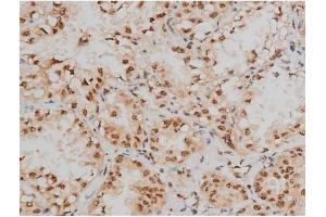 Immunohistochemistry (IHC) image for anti-cAMP Responsive Element Binding Protein 1 (CREB1) (pSer133) antibody (ABIN6256130)