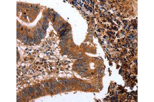 Immunohistochemistry (IHC) image for anti-C-Type Lectin Domain Family 4, Member A (CLEC4A) antibody (ABIN1871908) (CLEC4A 抗体)