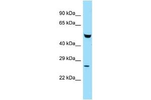WB Suggested Anti-Faf2 Antibody Titration: 1. (FAF2 抗体  (N-Term))