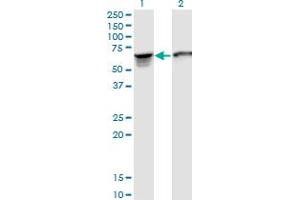 Western Blot analysis of STIP1 expression in transfected 293T cell line by STIP1 monoclonal antibody (M35), clone 2E11. (STIP1 抗体  (AA 1-543))