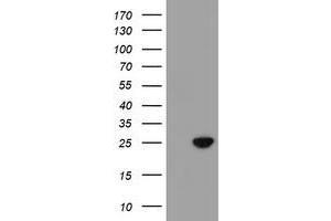 Western Blotting (WB) image for anti-Chromosome 21 Open Reading Frame 56 (C21orf56) antibody (ABIN1497041) (C21ORF56 抗体)