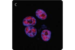 Image no. 2 for anti-Poly (ADP-Ribose) Polymerase 1 (PARP1) (N-Term) antibody (ABIN307559) (PARP1 抗体  (N-Term))