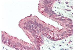 Rabbit Anti-RNF165 antibody  Formalin Fixed Paraffin Embedded Tissue: Human Lung, Respiratory Epithelium Primary antibody Concentration: 1:100 Secondary Antibody: Donkey anti-Rabbit-Cy3 Secondary Antibody Concentration: 1:200 Magnification: 20x Exposure Time: 0. (RNF165 抗体  (Middle Region))