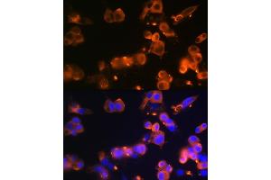 Immunofluorescence (IF) image for anti-Solute Carrier Family 2 (Facilitated Glucose Transporter), Member 2 (SLC2A2) antibody (ABIN7270414)