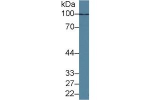 Detection of HDAC9 in Human K562 cell lysate using Polyclonal Antibody to Histone Deacetylase 9 (HDAC9) (HDAC9 抗体  (AA 23-343))