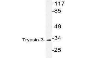 Western blot (WB) analysis of Trypsin-3 antibody in extracts from A549 cells (PRSS3 抗体)