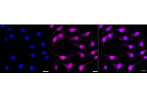 Immunocytochemical staining of HeLa cells with NFE2 antibody (ABIN7799633), 1:1,000). (Recombinant NFE2 抗体)