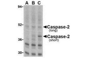 Western blot analysis of caspase-2 in Ramos cells with AP30196PU-N caspase-2 antibody at (A) 0. (Caspase 2 抗体  (N-Term))